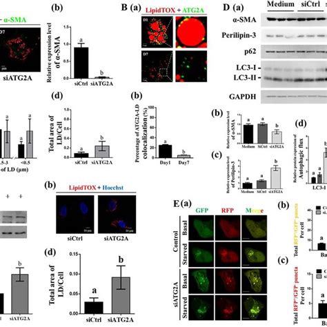 Involvement Of Atg2a In Hepatic Stellate Cell Hsc Activation A Download Scientific Diagram