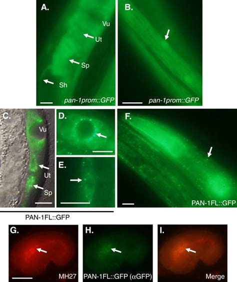 Pan 1 GFP Expression Pattern A Expression Of Pan 1prom GFP In The