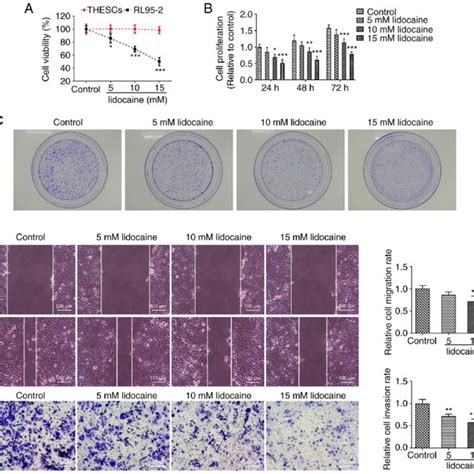 Lidocaine Inhibits The Proliferation Invasion And Migration Of