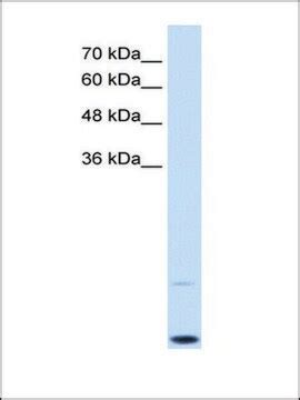 Myc Ab Antibody Western Av Anti C Myc