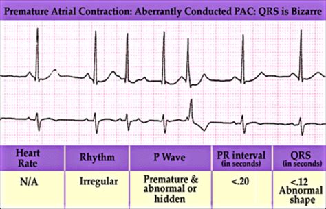 Em Exam Dysrhythmias Vascular Emergencies Valvular Disease