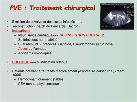 Ppt Prise En Charge D’une Endocardite Infectieuse Sur Prothese Powerpoint Presentation Id