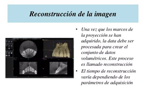 Tomografia De Haz Conico Cone Beam En Odontologia Ppt