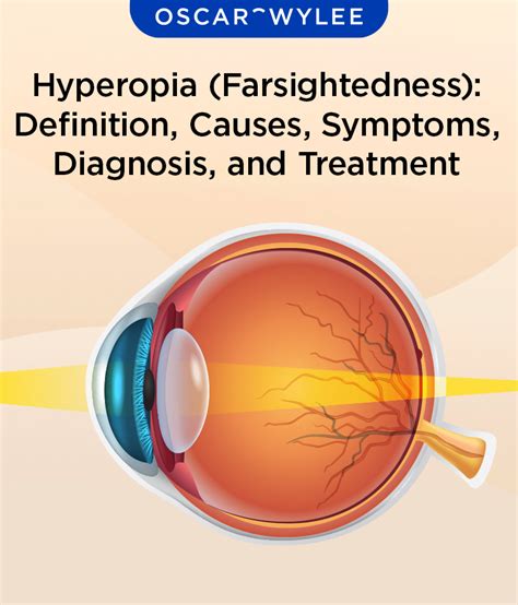 Hyperopia Correction