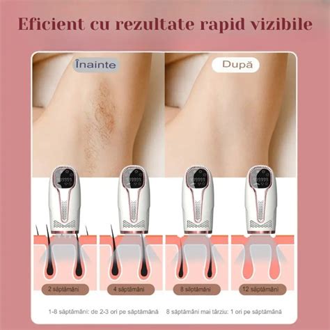 Epilator IPL ShareShop Epilare Definitiva Fara Durere 999 999