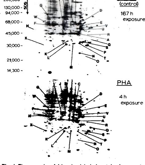 Figure 1 From Computer Assisted Analysis Of Two Dimensional