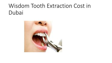 Ppt Wisdom Tooth Extraction Cost In Dubai Powerpoint Presentation Free Download Id 10881484