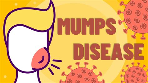 Mumps Disease Causes Symptoms Diagnosis Complications Management Mumps Animation In 2022