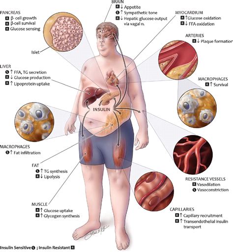 Tissuespecific Insulin Signaling Metabolic Syndrome And