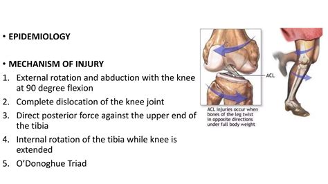 Ligaments Injuries Around Knee Pptx