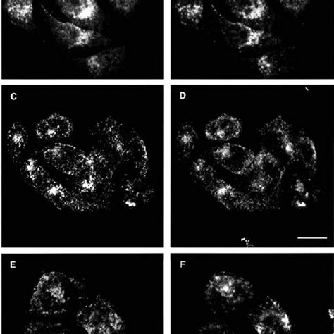 Relative Intracellular Distribution Of SCAMP Paralogs HeLa Cells Were