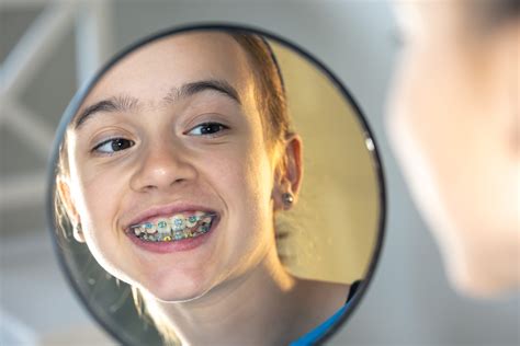 Maintaining Oral Hygiene With Braces A Step By Step Guide Simplybraces