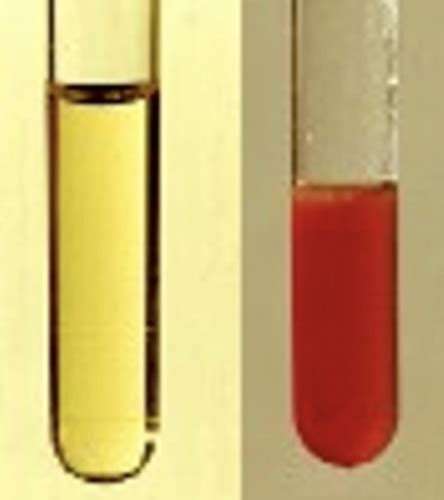 Clinical Pathology 4 Urinalysis Flashcards Quizlet