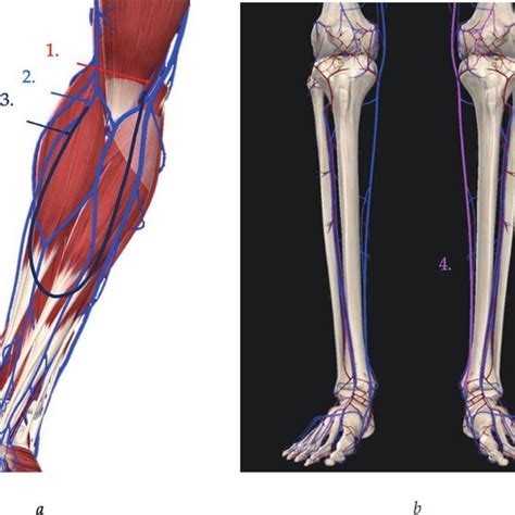 Modeling of the saphenous vein graft in Complete Anatomy 2020 app. (a ...