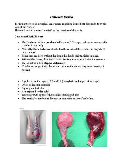 Testicular Torsion Causes And Risk Factors Pdf Medical Specialties Health Sciences