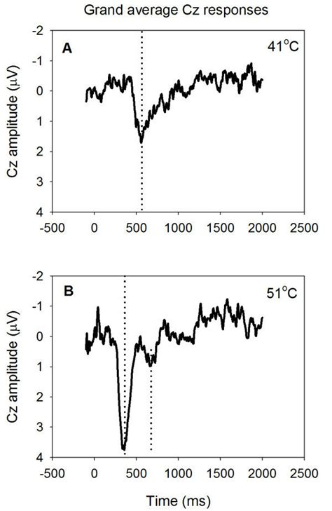 Vertex Cz Potentials Evoked By Contact Heat Pulses Applied To The Download Scientific Diagram