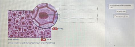 Solved Simple Squamous Epithelium Of Peritoneum Mesothelial