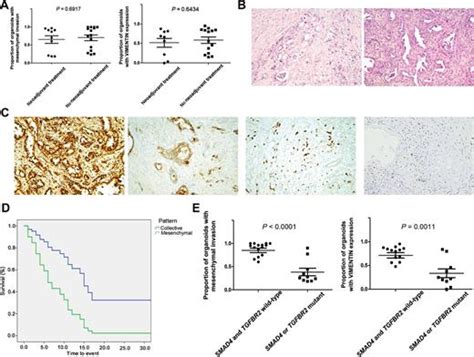 Pattern Of Invasion In Human Pancreatic Cancer Organoids Is Associated