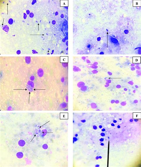 Giemsa Stained Impression Smears Of Liver Spleen And Brain Revealing