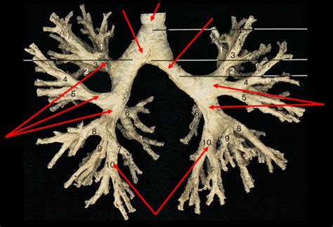gross anatomy   trachea  lungs diagram quizlet