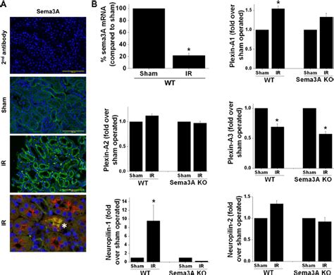 Regulation Of Expression Of Semaphorin3a Sema3a And Its Receptors In