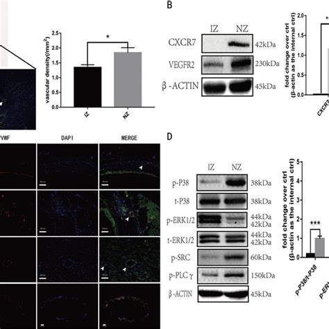 The Expression Of Cxcr And The Angiogenesis Pathway Were Downregulated