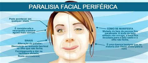 Acupuntura E Fisioterapia Dois Aliados Na Cura Da Paralisia Facial