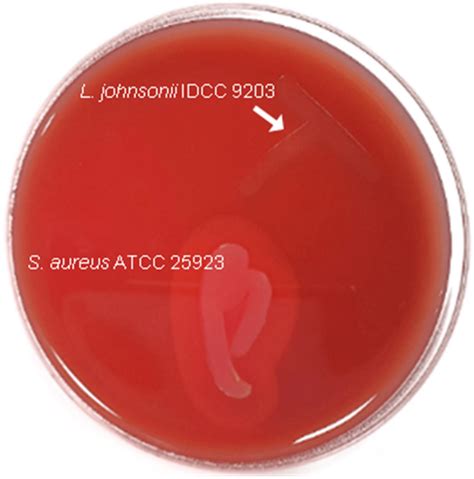 β Hemolytic activity of Lactobacillus johnsonii IDCC 9203 L johnsonii