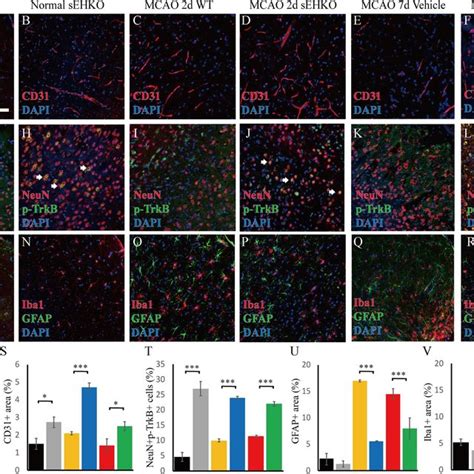 Pharmacological Inhibition And Gene Deletion Of Soluble Epoxide