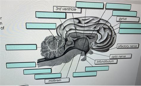 Infundibulum Brain