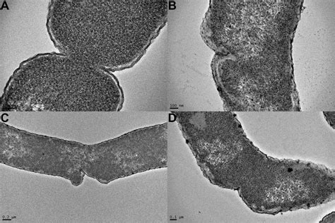 Transmission Electron Microscopy Of Thin Sections Of Dividing Wm2738