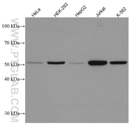 Calreticulin Antibody 80017 1 Rr Proteintech