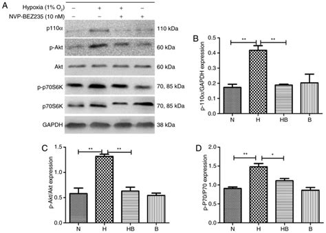 Hypoxia Induces Pulmonary Arterial Fibroblast Proliferation Migration