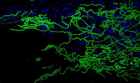 Sim Hms Super Resolution Microscopy In The Department Of Cell Biology At Harvard Medical School