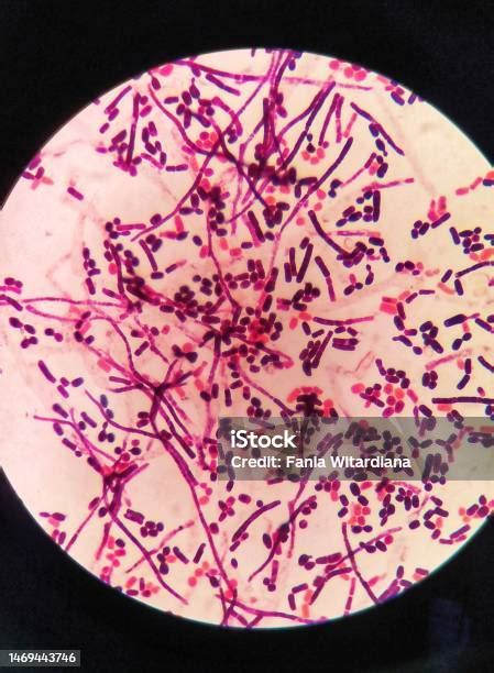 Yeast Cells And Hyphae In Gram Stain Fine With Microscope Stock Photo - Download Image Now - iStock