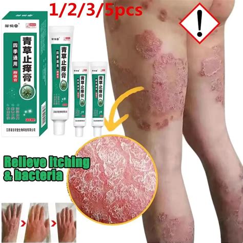 Herbal Antibacterial Cream Psoriasis Cream Itching Relief Eczema Rash