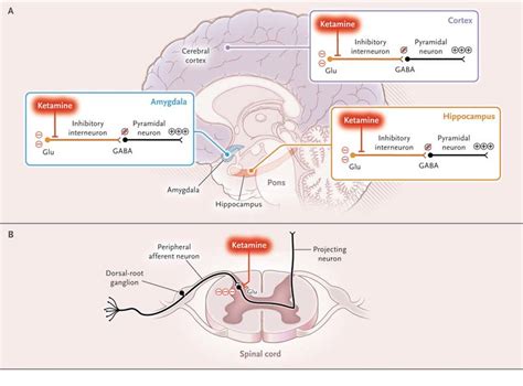 Unconsciousness And Active Brain States Ketamine Binds Preferentially