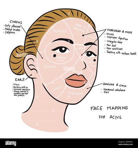 Face Mapping For Acne Beautiful Woman Face Vector Illustration Stock