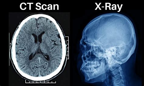 The Difference Between CT Scan And X-Ray - Kiran Lab