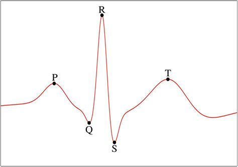 Scielo Brasil Modelo Matem Tico Para A Reprodu O De Sinais De Ecg