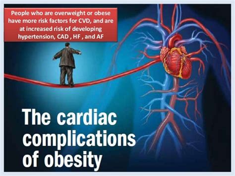 Obesity And Cardiovascular Disease