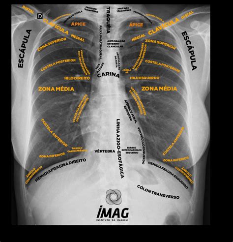 Torax Como Fazer Diagnosticos Atraves Da Radiografia E Tomografia