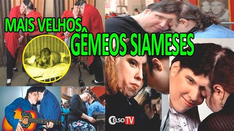 Os G Meos Siameses Mais Velhos Do Mundo Youtube