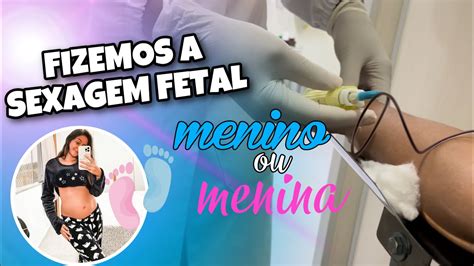 Fizemos A Sexagem Fetal E Revelamos Tudo Youtube