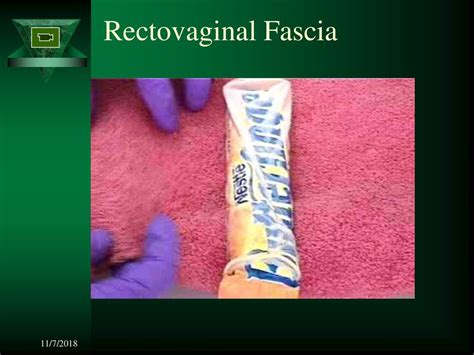 Perineal Repair Workshop Ppt Download