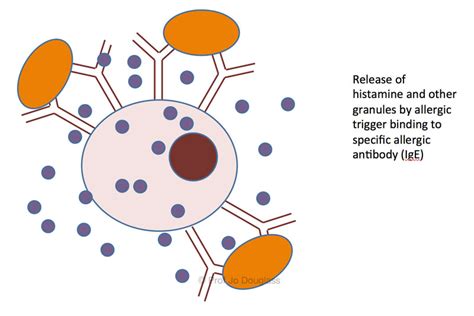 Anaphylaxis Melbourne Allergy Asthma And Immunology Specialists