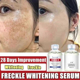 HOUMAI Effective Freckle Whitening Serum 50ml Face Freckles Remove Anti