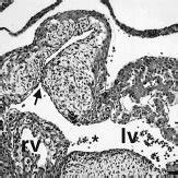 Lack Of Conotruncal Rotation In E Perlecan Deficient Embryos