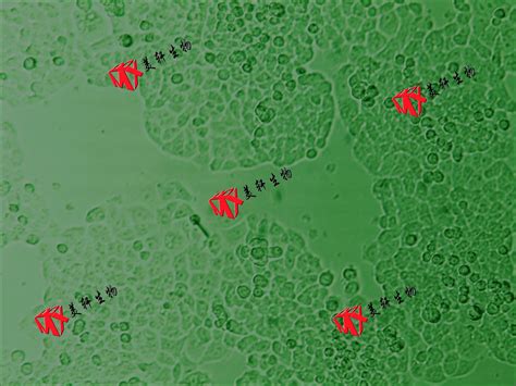 Mda Mb 453 Gfp人乳腺癌细胞 绿色标记价格品牌atcc 丁香通官网