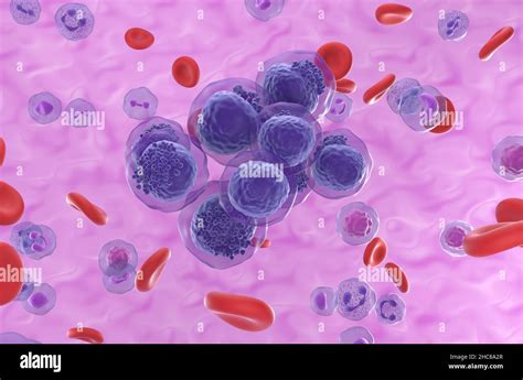 Acute Myeloid Leukemia Aml Cells Cluster In Blood Flow Isometric